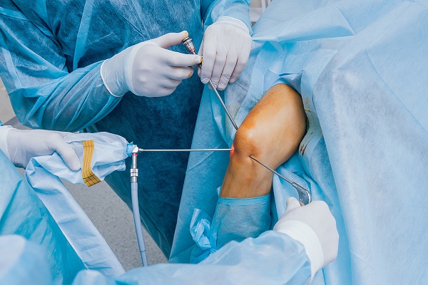 Arthroscopic Knee Surgery: Minimally Invasive Solutions for Knee Problems